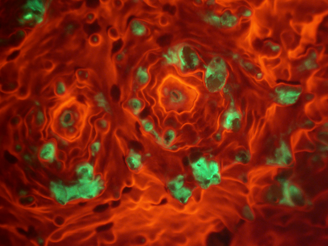 Echinophyllia coral composite imaging